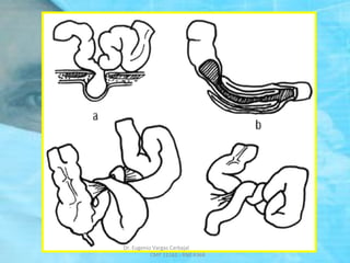 Dr. Eugenio Vargas Carbajal
CMP 11161 - RNE 4368
 