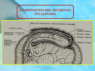 COMPONENTES DEL SEGMENTO
INVAGINADO
Dr. Eugenio Vargas Carbajal
CMP 11161 - RNE 4368
 