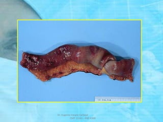 Dr. Eugenio Vargas Carbajal
CMP 11161 - RNE 4368
 