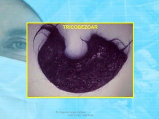 Dr. Eugenio Vargas Carbajal
CMP 11161 - RNE 4368
 