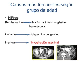 Causas más frecuentes según
grupo de edad
• Niños
Recién nacido Malformaciones congénitas
Íleo meconial
Lactante Megacolon congénito
Infancia Invaginación intestinal
 