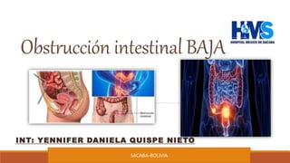 Obstrucción intestinal BAJA
INT: YENNIFER DANIELA QUISPE NIETO
SACABA-BOLIVIA
 