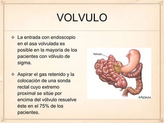 VOLVULO
La entrada con endoscopio
en el asa volvulada es
posible en la mayoría de los
pacientes con vólvulo de
sigma.

Aspirar el gas retenido y la
colocación de una sonda
rectal cuyo extremo
proximal se sitúe por
encima del vólvulo resuelve
éste en el 75% de los
pacientes.
 