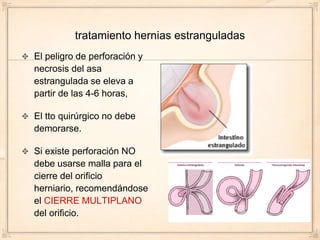 tratamiento hernias estranguladas
El peligro de perforación y
necrosis del asa
estrangulada se eleva a
partir de las 4-6 horas,

El tto quirúrgico no debe
demorarse.

Si existe perforación NO
debe usarse malla para el
cierre del orificio
herniario, recomendándose
el CIERRE MULTIPLANO
del orificio.
 