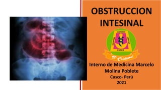 OBSTRUCCION
INTESINAL
Interno de Medicina Marcelo
Molina Poblete
Cusco- Perú
2021
 