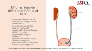 Stents Rinones Obstruccion pielo ureteral opu cirugia pediatrica.pptx