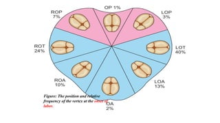 Figure: The position and relative
frequency of the vertex at the onset of
labor.
 