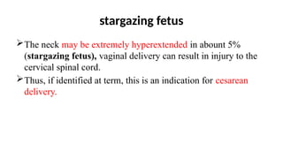 stargazing fetus
The neck may be extremely hyperextended in abount 5%
(stargazing fetus), vaginal delivery can result in injury to the
cervical spinal cord.
Thus, if identified at term, this is an indication for cesarean
delivery.
 