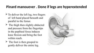 Pinard manouever . Done if legs are hyperextended
 To deliver the left leg, two fingers
of left hand placed beneath and
parallel to the femur.
 The thigh then slightly abducted
and pressure from the fingertips
in the popliteal fossa induces
knee flexion and bring the foot
within reach.
 The foot is then grasped to
gently deliver the entire leg.
 