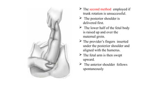  The second method employed if
trunk rotation is unsuccessful.
 The posterior shoulder is
delivered first.
 The lower half of the fetal body
is raised up and over the
maternal groin.
 The provider’s fingers inserted
under the posterior shoulder and
aligned with the humerus.
 The fetal arm is then swept
upward.
 The anterior shoulder follows
spontaneously
 