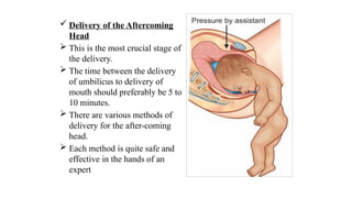  Delivery of the Aftercoming
Head
 This is the most crucial stage of
the delivery.
 The time between the delivery
of umbilicus to delivery of
mouth should preferably be 5 to
10 minutes.
 There are various methods of
delivery for the after-coming
head.
 Each method is quite safe and
effective in the hands of an
expert
 