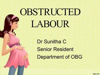 OBSTRUCTED
LABOUR
Dr Sunitha C
Senior Resident
Department of OBG
 