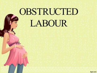 OBSTRUCTED
LABOUR
 