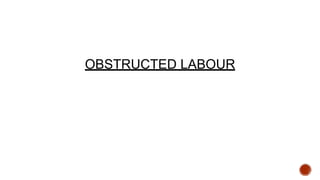 OBSTRUCTED LABOUR
 