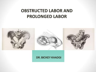 DR. BICKEY KHADGI
OBSTRUCTED LABOR AND
PROLONGED LABOR
1
 