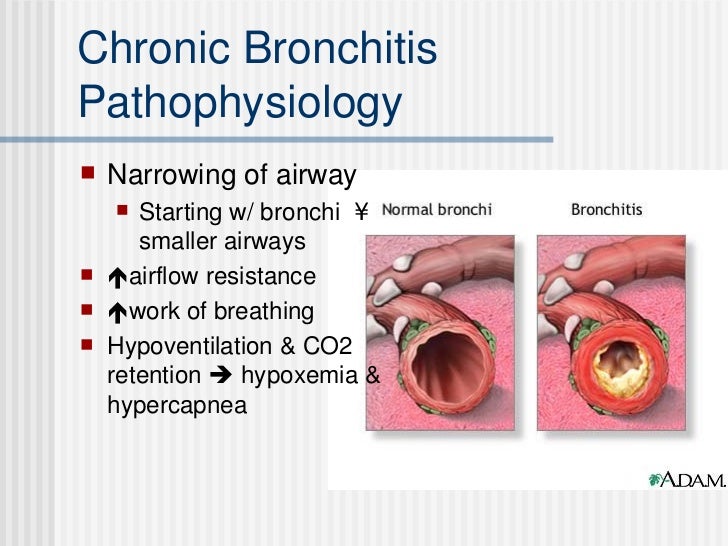 Obstructive And Inflammatory Lung Disease
