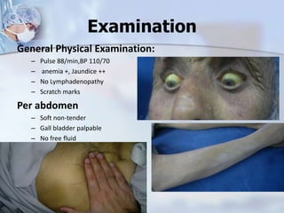 Examination
General Physical Examination:
– Pulse 88/min,BP 110/70
– anemia +, Jaundice ++
– No Lymphadenopathy
– Scratch marks
Per abdomen
– Soft non-tender
– Gall bladder palpable
– No free fluid
 