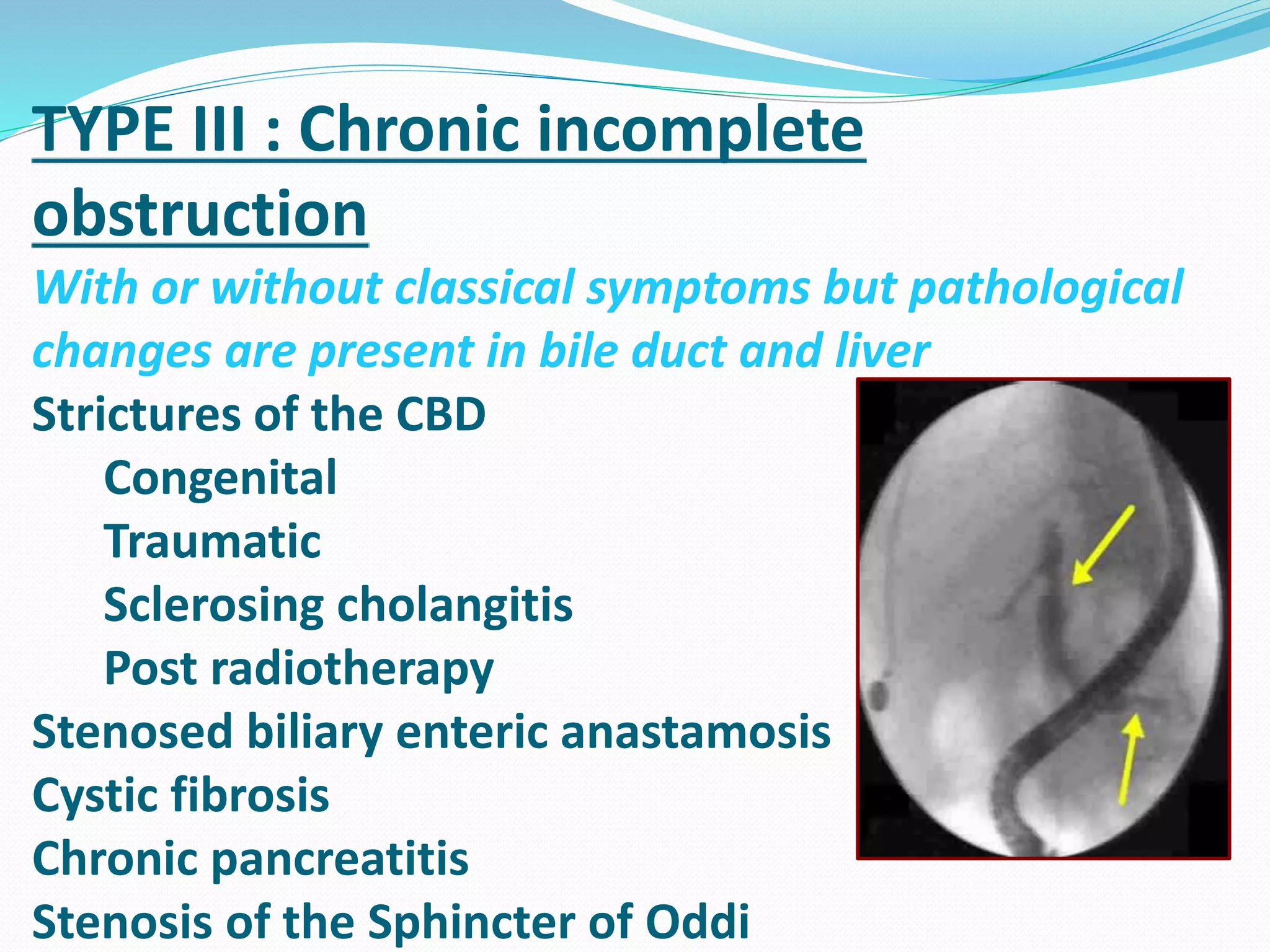 TYPE III : Chronic incomplete
obstruction
With or without classical symptoms but pathological
changes are present in bile duct and liver
Strictures of the CBD
Congenital
Traumatic
Sclerosing cholangitis
Post radiotherapy
Stenosed biliary enteric anastamosis
Cystic fibrosis
Chronic pancreatitis
Stenosis of the Sphincter of Oddi
 