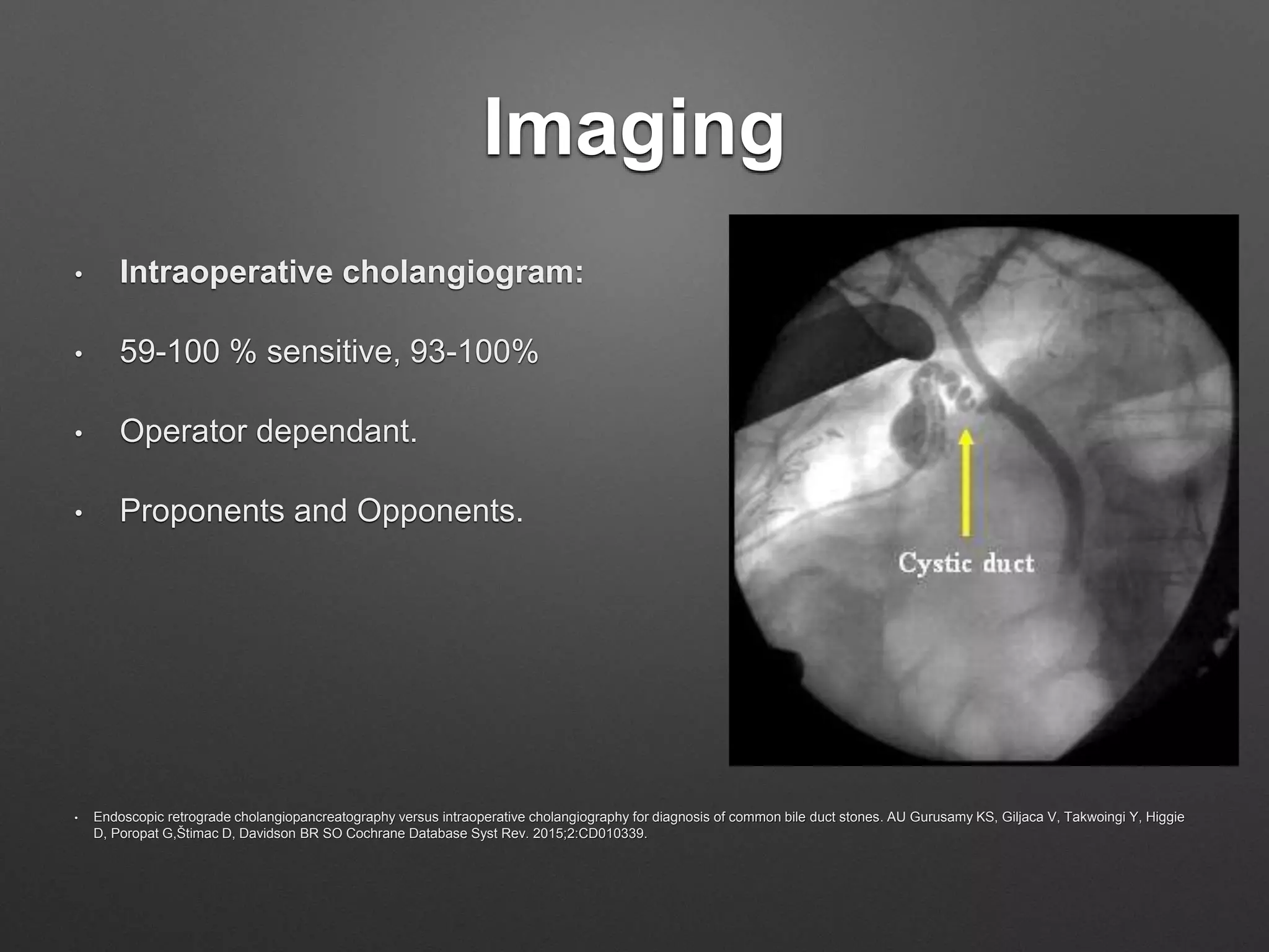Imaging
• Intraoperative cholangiogram:
• 59-100 % sensitive, 93-100%
• Operator dependant.
• Proponents and Opponents.
• Endoscopic retrograde cholangiopancreatography versus intraoperative cholangiography for diagnosis of common bile duct stones. AU Gurusamy KS, Giljaca V, Takwoingi Y, Higgie
D, Poropat G,Štimac D, Davidson BR SO Cochrane Database Syst Rev. 2015;2:CD010339.
 