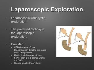Laparoscopic Exploration
• Laparoscopic transcystic
exploration
• The preferred technique
for Laparoscopic
exploration.
• Provided:
• CBD diameter <6 mm
• Stone location distal to the cystic
duct/CBD junction
• Cystic duct diameter >4 mm
• Fewer than 6 to 8 stones within
the CBD
• Stones smaller than 10 mm
 