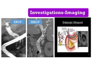 Investigations-Imaging
ERCP MRCP
 