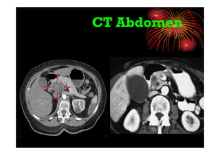 CT Abdomen
 