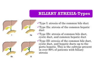 BILIARY ATRESIA-Types
Type I: atresia of the common bile duct
Type IIa: atresia of the common hepatic
duct
Type IIb: atresia of common bile duct,
cystic duct, and common hepatic duct
Type III: atresia of the common bile duct,
cystic duct, and hepatic ducts up to the
porta hepatis. This is the subtype present
in over 90% of patients with biliary
atresia
 