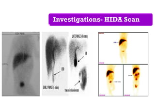 Investigations- HIDA Scan
 
