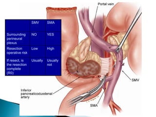 SMV SMA
Surrounding
perineural
plexus
NO YES
Resection
operative risk
Low High
If resect, is
the resection
complete
(R0)
Usually Usually
not
 
