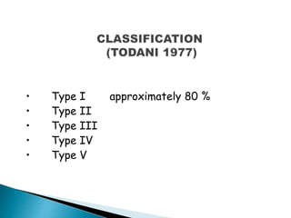 • Type I approximately 80 %
• Type II
• Type III
• Type IV
• Type V
 
