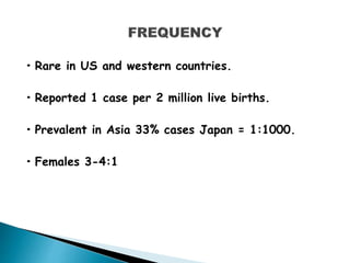 • Rare in US and western countries.
• Reported 1 case per 2 million live births.
• Prevalent in Asia 33% cases Japan = 1:1000.
• Females 3-4:1
 