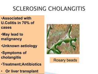 •Associated with
U.Colitis in 70% of
cases
•May lead to
malignancy
•Unknown aetiology
•Symptoms of
cholangitis
•Treatment;Antibiotics
• Or liver transplant
Rosary beads
 