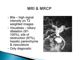  Bile – high signal
intensity on T2
weighted images
 Visualises – biliary
dilatation (97-
100%), site of
obstruction (87%),
hepatic parenchyma
& vasculature
 Only diagnostic
 