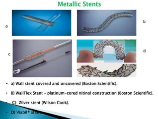 Metallic Stents
 a) Wall stent covered and uncovered (Boston Scientific).
• B) WallFlex Stent – platinum-cored nitinol construction (Boston Scientific).
• C) Zilver stent (Wilson Cook).
• D) Viabil® stent.
a
b
c
d
 