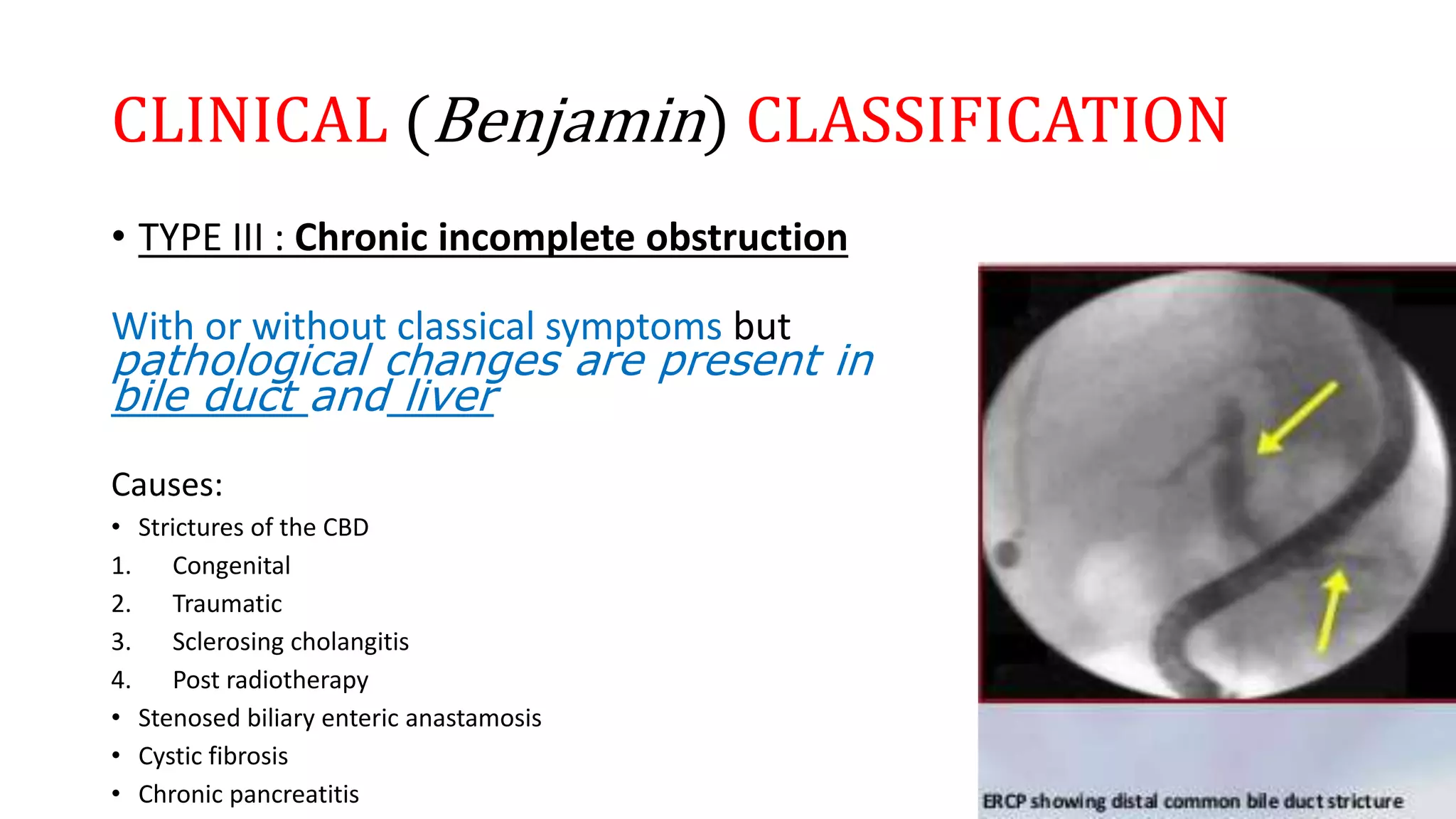 CLINICAL (Benjamin) CLASSIFICATION
• TYPE III : Chronic incomplete obstruction
With or without classical symptoms but
pathological changes are present in
bile duct and liver
Causes:
• Strictures of the CBD
1. Congenital
2. Traumatic
3. Sclerosing cholangitis
4. Post radiotherapy
• Stenosed biliary enteric anastamosis
• Cystic fibrosis
• Chronic pancreatitis
 