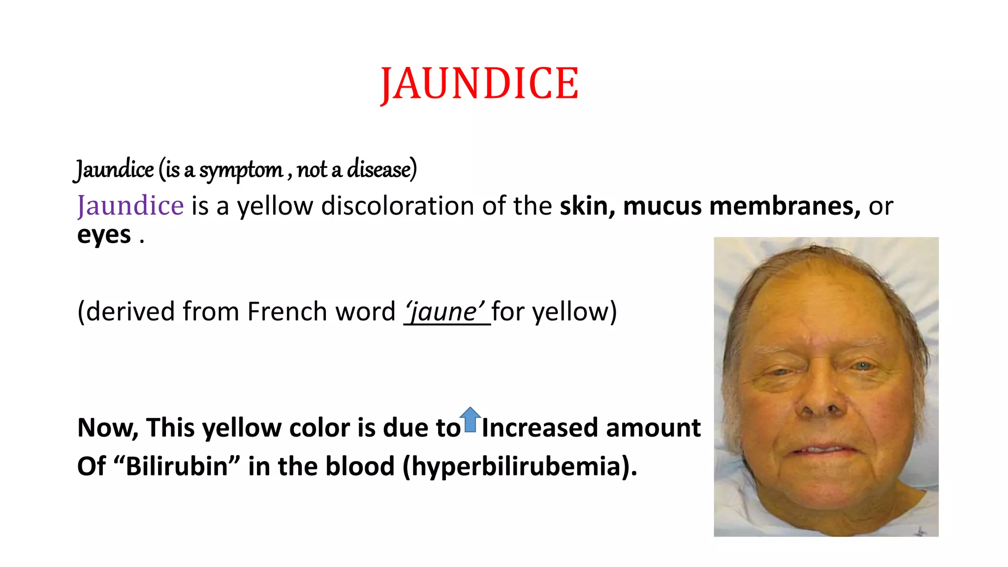 JAUNDICE
Jaundice (is a symptom, not a disease)
Jaundice is a yellow discoloration of the skin, mucus membranes, or
eyes .
(derived from French word ‘jaune’ for yellow)
Now, This yellow color is due to Increased amount
Of “Bilirubin” in the blood (hyperbilirubemia).
 