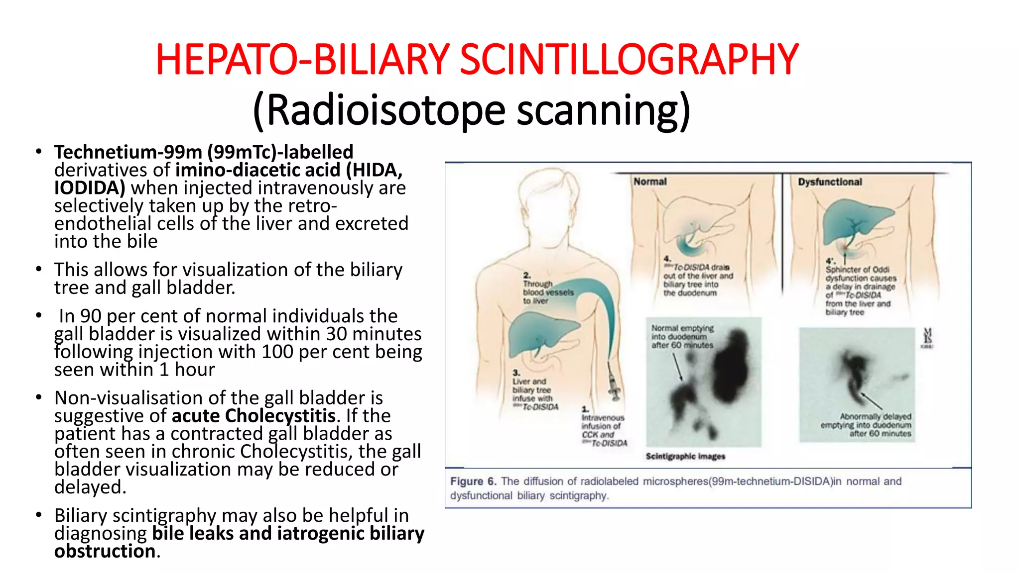 HEPATO-BILIARY SCINTILLOGRAPHY
(Radioisotope scanning)
• Technetium-99m (99mTc)-labelled
derivatives of imino-diacetic acid (HIDA,
IODIDA) when injected intravenously are
selectively taken up by the retro-
endothelial cells of the liver and excreted
into the bile
• This allows for visualization of the biliary
tree and gall bladder.
• In 90 per cent of normal individuals the
gall bladder is visualized within 30 minutes
following injection with 100 per cent being
seen within 1 hour
• Non-visualisation of the gall bladder is
suggestive of acute Cholecystitis. If the
patient has a contracted gall bladder as
often seen in chronic Cholecystitis, the gall
bladder visualization may be reduced or
delayed.
• Biliary scintigraphy may also be helpful in
diagnosing bile leaks and iatrogenic biliary
obstruction.
 