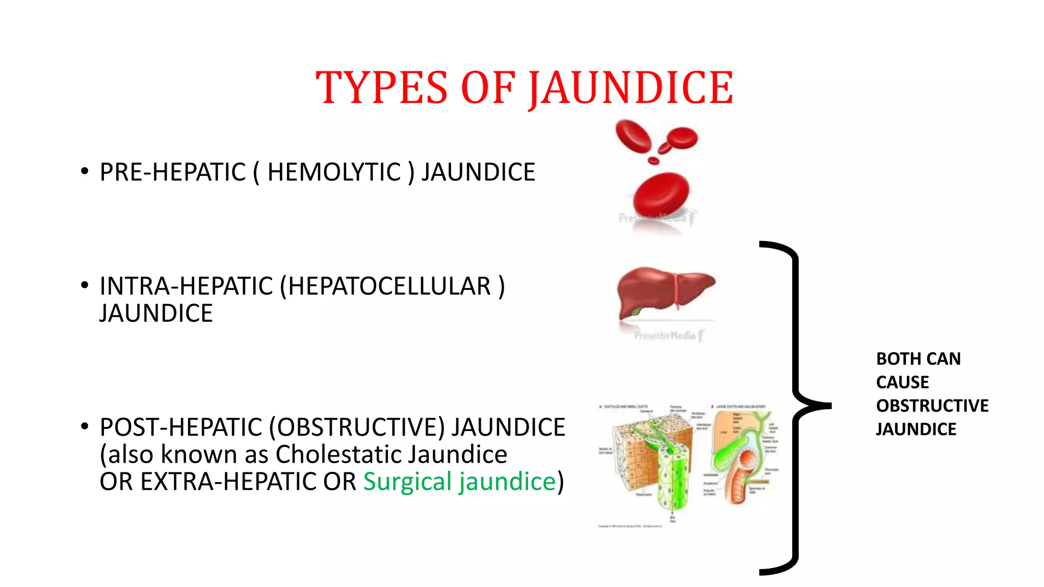 TYPES OF JAUNDICE
• PRE-HEPATIC ( HEMOLYTIC ) JAUNDICE
• INTRA-HEPATIC (HEPATOCELLULAR )
JAUNDICE
• POST-HEPATIC (OBSTRUCTIVE) JAUNDICE
(also known as Cholestatic Jaundice
OR EXTRA-HEPATIC OR Surgical jaundice)
BOTH CAN
CAUSE
OBSTRUCTIVE
JAUNDICE
 