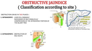 OBSTRUCTIVE JAUNDICE
( Classification according to site )
OBSTRUCTION CAN BE IN TWO PLACES:-
1. INTRAHEPATIC - LIVER CELL DAMAGE/
BLOCAKAGE OF BILE CANALICULI/
COMPRESSION OF THE INTRAHEPAIC PORTION OF
THE BILIARY TREE
2. EXTRAHEPATIC - OBSTRUCTION OF
BILE DUCTS
ONLY INCLUDES INSIDE OF BLUE LINE
(INTRAHEPAIC PORTION OF THE BILIARY TREE)
 