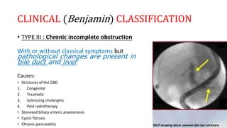 CLINICAL (Benjamin) CLASSIFICATION
• TYPE III : Chronic incomplete obstruction
With or without classical symptoms but
pathological changes are present in
bile duct and liver
Causes:
• Strictures of the CBD
1. Congenital
2. Traumatic
3. Sclerosing cholangitis
4. Post radiotherapy
• Stenosed biliary enteric anastamosis
• Cystic fibrosis
• Chronic pancreatitis
 