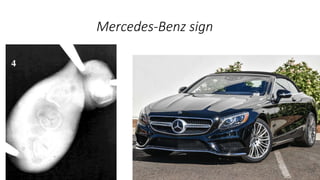 Mercedes-Benz sign
 