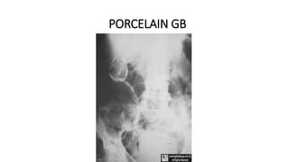 PORCELAIN GB
 
