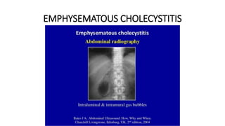 EMPHYSEMATOUS CHOLECYSTITIS
 