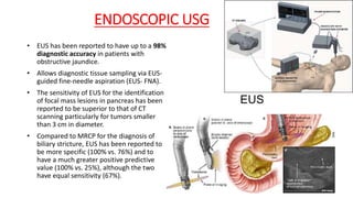 ENDOSCOPIC USG
• EUS has been reported to have up to a 98%
diagnostic accuracy in patients with
obstructive jaundice.
• Allows diagnostic tissue sampling via EUS-
guided fine-needle aspiration (EUS- FNA).
• The sensitivity of EUS for the identification
of focal mass lesions in pancreas has been
reported to be superior to that of CT
scanning particularly for tumors smaller
than 3 cm in diameter.
• Compared to MRCP for the diagnosis of
biliary stricture, EUS has been reported to
be more specific (100% vs. 76%) and to
have a much greater positive predictive
value (100% vs. 25%), although the two
have equal sensitivity (67%).
 