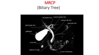 MRCP
(Biliary Tree)
 