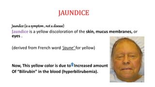 JAUNDICE
Jaundice (is a symptom, not a disease)
Jaundice is a yellow discoloration of the skin, mucus membranes, or
eyes .
(derived from French word ‘jaune’ for yellow)
Now, This yellow color is due to Increased amount
Of “Bilirubin” in the blood (hyperbilirubemia).
 