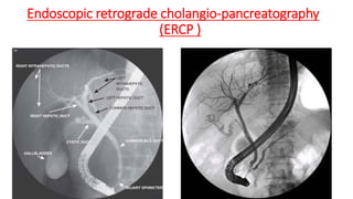 Endoscopic retrograde cholangio-pancreatography
(ERCP )
 