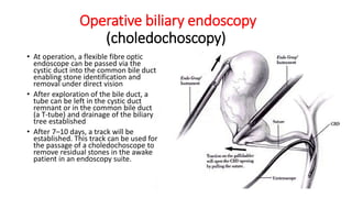 Operative biliary endoscopy
(choledochoscopy)
• At operation, a flexible fibre optic
endoscope can be passed via the
cystic duct into the common bile duct
enabling stone identification and
removal under direct vision
• After exploration of the bile duct, a
tube can be left in the cystic duct
remnant or in the common bile duct
(a T-tube) and drainage of the biliary
tree established
• After 7–10 days, a track will be
established. This track can be used for
the passage of a choledochoscope to
remove residual stones in the awake
patient in an endoscopy suite.
 