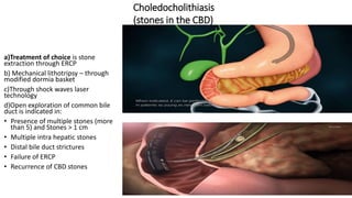 Choledocholithiasis
(stones in the CBD)
a)Treatment of choice is stone
extraction through ERCP
b) Mechanical lithotripsy – through
modified dormia basket
c)Through shock waves laser
technology
d)Open exploration of common bile
duct is indicated in:
• Presence of multiple stones (more
than 5) and Stones > 1 cm
• Multiple intra hepatic stones
• Distal bile duct strictures
• Failure of ERCP
• Recurrence of CBD stones
 