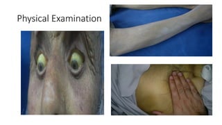 Physical Examination
 